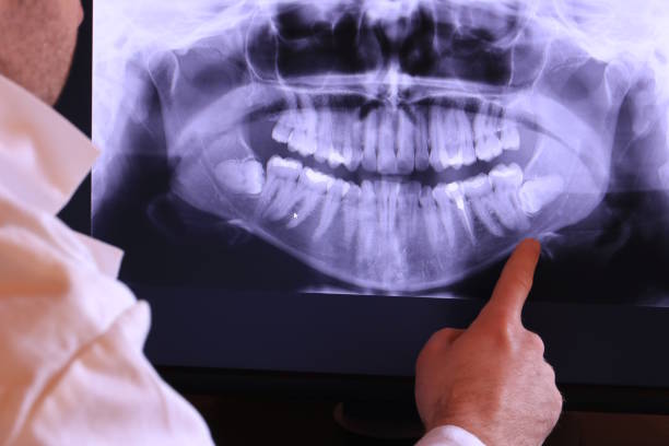 Best Emergency Orthodontic Repairs in Bret Harte, CA