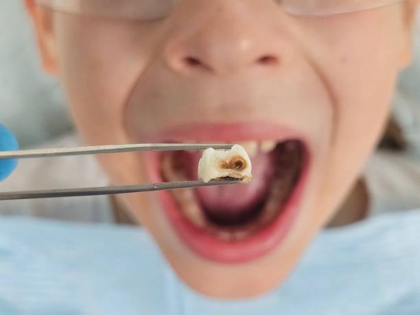 Best Urgent Dental Care in Bret Harte, CA